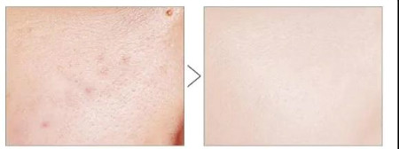 weixintupian_20210405141639.jpg weixintupian_20210405141639.jpg